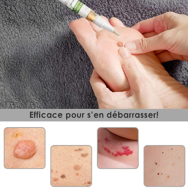 Gadgets d'Eve TAGFREE™ : Stylo Anti-Verrue